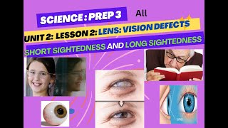 Science prep3unit2lesson2lensVision defects1st term20242025 [upl. by Newlin]