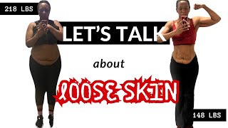 The TRUTH About Loose Skin After Weight Loss  Before amp After [upl. by Erikson79]