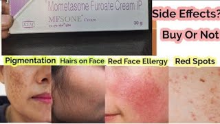 Mometasone furoate Cream IP uses side effects dose and all information in one vedio [upl. by Inaluiak995]