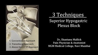 Superior Hypogastric Plexus Block 3 Techniques [upl. by Ocirnor358]