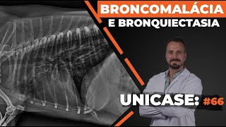 UNICASE 66  Broncomalácia e bronquiectasia [upl. by Rutledge]