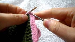 Icord buttonhole method [upl. by Ynatsed]