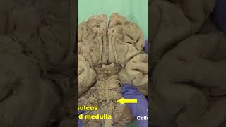 Ventral side of pons and medulla neuroanatomybrainstembrainhumanbrain [upl. by Waldemar]