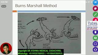 Burn marshalls maneuver for breech presentation BY DRVISHWA MEDICAL COACHING WHATSAPP 919930788955 [upl. by Nairadal]