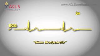 Sinus Bradycardia by ACLS Certification Institute [upl. by Nosirrah73]