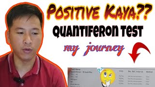 🔴 Positive kaya Quantiferon Test Kinabahan ako [upl. by Nivel221]