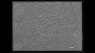 Intranuclear Herpesvirus Capsids Revealed by CryoFIBET [upl. by Rolyat981]