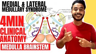 medulla oblongata clinical anatomy  medial medullary syndrome clinical anatomy of brainstem [upl. by Justin]