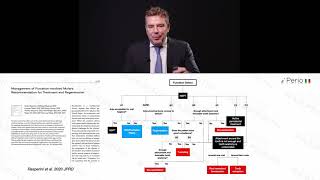 Management of furcation involvement [upl. by Trilby358]