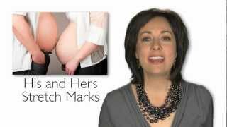 Plastic Surgery Update Stretch Mark Removal for Men Procedures for Brides Liposonix [upl. by Nikkie810]