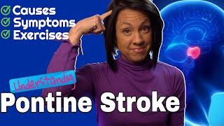 Pontine Stroke Causes symptoms and best exercises [upl. by Lindell]