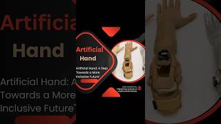 Artificial Hand Restoring Independence and Mobilityquot [upl. by Tynan483]