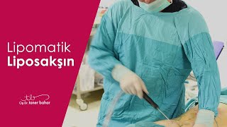 Lipomatik Nedir  İnfrasonik Liposuction Güldüren Liposakşın  OpDrTaner Bahar [upl. by Yhtur]