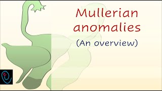 Mullerian anomalies  an overview [upl. by Aniram]