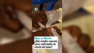 Mpox en México ¿Qué estados ya reportan casos confirmados de viruela del mono [upl. by Mimajneb]