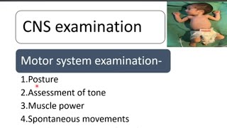 CNS Examination in Newborn  Newborn Examination Part9  Pediatrics [upl. by Arfihs]