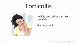 Torticollis [upl. by Niple894]