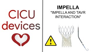 IMPELLA AND TAVRTAVI INTERACTION ALSO FOR SUTURELESS AND CALCIFIED AORTIC VALVES [upl. by Lyris]