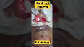 Nasal pack removal [upl. by Aehtla]