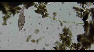 Cyanobacteria added to an Anaerobic sample of soil in a jar with water [upl. by Irap226]