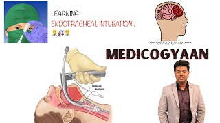 What is Endotracheal Intubation [upl. by Woothen357]