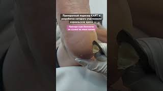 🎁 Дарю курс по препаратному педикюру KART по ссылке у меня на канале pedicur nailart shortvideo [upl. by Downes704]