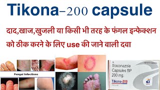 Tikona 200 capsule uses in hindiitraconazole capsule uses in hindifungal infections ka treatment [upl. by Golanka]