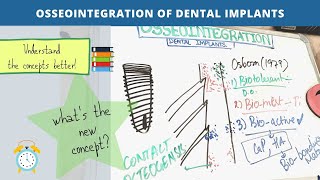 osseointegration of dental implants Part  2 [upl. by Esiuqcaj]