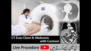 Live CT Scan of Chest  Abdomen with demonstration of Planning and procedure [upl. by Camden672]