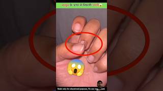 नाखून से निकली उंगली😱 amazingfacts nails nailart factsinhindi amazing facts navysong hairsty [upl. by Friedland961]