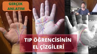 Tıp Öğrencisinin El Çizgileri  Gerçek Anlatım  Elinizdeki Miras Çizgileri  Altın Çoçuk [upl. by Natsud]