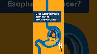 Does GERD Increase Your Risk of Esophageal Cancer [upl. by Rentsch]