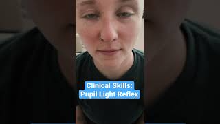 Pupil Light Reflex Clinical Skills  LevelUpRN [upl. by Aibun]