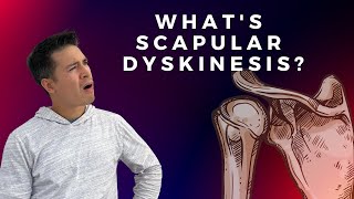 Scapular Dyskinesis and Shoulder Pain [upl. by Jedlicka790]