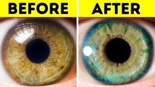 7 Things That Can Change Your Eye Color [upl. by Bethanne]