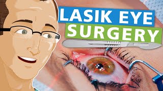 Lasik Eye Surgery [upl. by Yregerg]