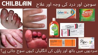 Chilblains causes and treatment سردیوں میں ہاتھ پاؤں کی انگلیاں کیوں سوج جاتی ہےدرد کی وجہ اور علاج [upl. by Hanoy]