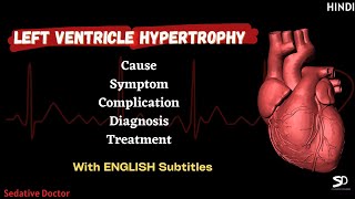 LVH  Left Ventricular Hypertrophy  Cause Symptoms Treatment  Hindi  Sedative Doctor [upl. by Anisirhc]