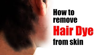 How to remove hair dye from skin [upl. by Yllatan]