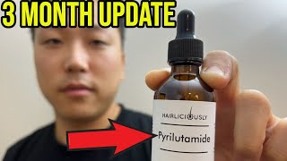 MY 3 MONTH UPDATE ON PYRILUTAMIDE KX826 [upl. by Rene]