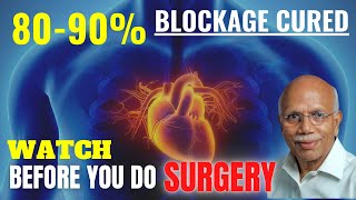 DONT WORRY If Your Artery Has Blocks  Dr B M Hegde [upl. by Fabien]