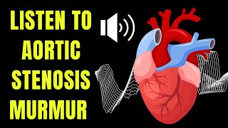 Doctor explains AORTIC STENOSIS including real heart SOUNDS of the murmur [upl. by Latvina]