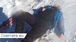 Shoulder dislocation accident while skiing [upl. by Uela677]