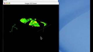 ImageJ 3D viewer demo part 1 [upl. by Justin]