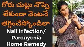 గోరు చుట్టుGoru Chuttu Home RemedyNail Infection treatment at homeParonychiaBest Remedy telugu [upl. by Odlanar699]