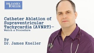 Catheter Ablation of Supraventricular Tachycardia AVNRT  Watch a Procedure [upl. by Suellen207]