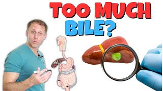 Do I Have Too Much Bile Biliary Hyperkinesia [upl. by Livvy373]