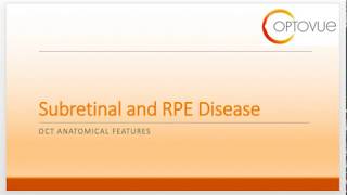 OCT Interpretation Session 5 Subretinal and RPE Disease [upl. by Feeley507]