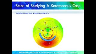 Quick Guide to the Management of Keratoconus Part 14 [upl. by Mastrianni]