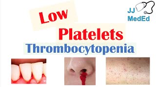 Thrombocytopenia  Signs and Symptoms and Approach to Causes [upl. by Adnomar17]